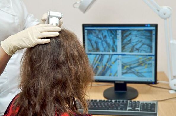 Izvajanje diagnostične trihoskopije