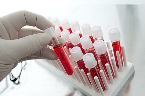 Krvni test za predpisovanje individualnega zdravljenja alopecije